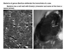 bacillus-lung-em.jpg