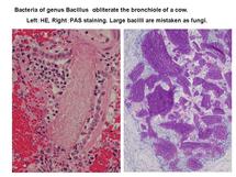 bacillus-lung.jpg