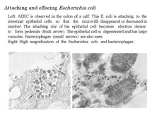 ecoli4.jpg