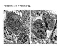 toxoplasma-em.jpg