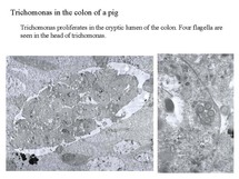 tricho4.jpg