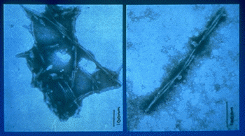 プリオン蛋白質(スクレイピー関連繊維)の電子顕微鏡写真 Bar=100nm