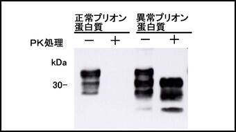ウェスタンブロット法