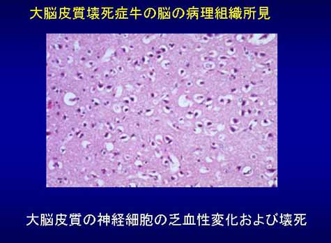 大脳皮質壊死症牛の脳の病理組織所見