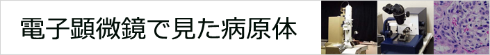 電子顕微鏡で見た病原体