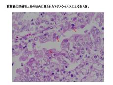 豚肝臓の尿細管上皮の核内に見られたアデノウイルスによる封入体