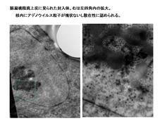 豚肝臓の尿細管上皮の核内に見られた封入体