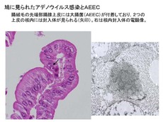 鳩に見られたアデノウイルス感染とAEEC