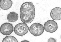 Actinobacillus suis
