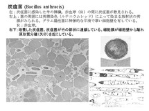 Bacillus anthrasis