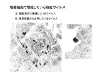 培養細胞で増殖している鶏痘ウイルス