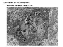 ムクドリの肝臓に見られたAtoxoplasma
