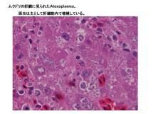 ムクドリの肝臓に見られたAtoxoplasma