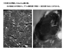 牛気管支を閉塞したBacillus属菌