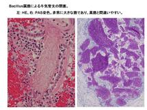 Bacillus属菌による牛気管支の閉塞