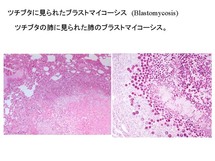 ツチブタの肺に見られたBlastomycosis