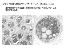 ツチブタの肺に見られたBlastomycosis