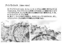 アイノウイルス