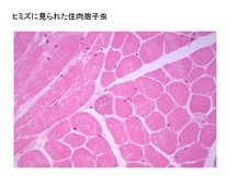 ヒミズに見られた住肉胞子虫