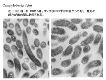 Campylobacter fetus