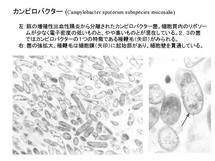 カンピロバクター