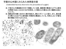 小豚の心外膜炎にみられた未同定の菌