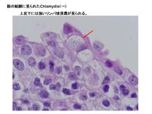 豚の結膜に見られたChlamydia
