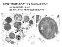 豚の顎下淋に見られたサーコウイルスによる封入体