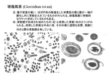 破傷風菌