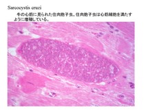 成熟したSarcocystis cruzi