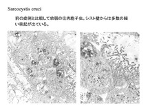 幼弱なSarcocystis cruzi