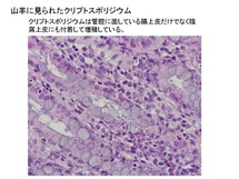 山羊に見られたクリプトスポリジウム