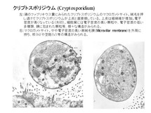 鶏に見られたクリプトスポリジウム