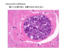 Sarcocystis sybillensis