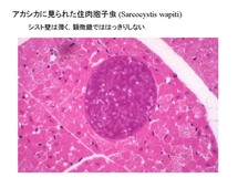 Sarcocystis wapiti