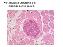 カモシカに見られた住肉胞子虫