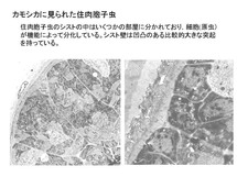 カモシカに見られた住肉胞子虫