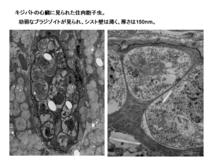 キジバトに見られた住肉胞子虫