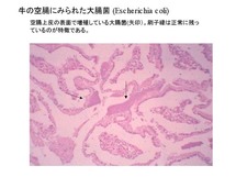 牛の空腸に見られた大腸菌