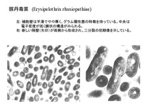 Erysipelothrix rhushiopathiae