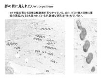 豚の胃に見られたGastrospirilium