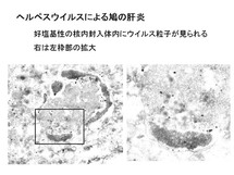 ヘルペスウイルスによる鳩の肝炎