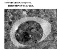 ヒヨドリの肺に見られたAtoxoplasma