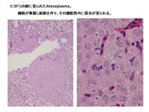 ヒヨドリの肺に見られたAtoxoplasma