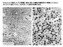 リンホシスティス病に罹患したブリの脾臓