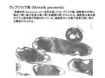 Klebsiella pneumoniae