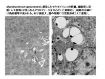 Mycobacterium genavense に感染したセキセイインコの肝臓