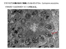 アズマモグラの腸上皮核内のコクシジウム