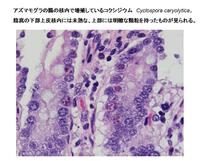 アズマモグラの腸上皮核内のコクシジウム