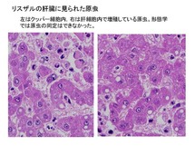 リスザルの肝臓に見られた原虫